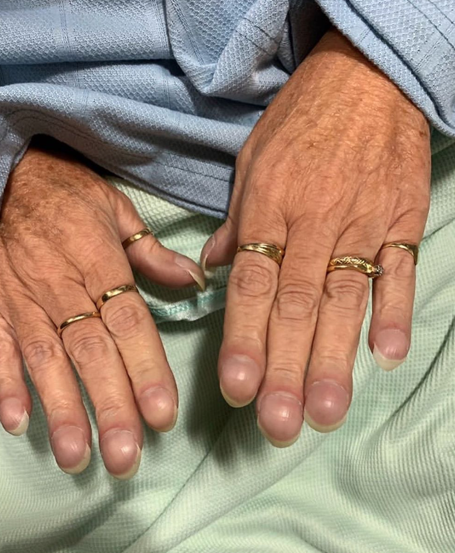 Extreme finger clubbing! MEDizzy Journal