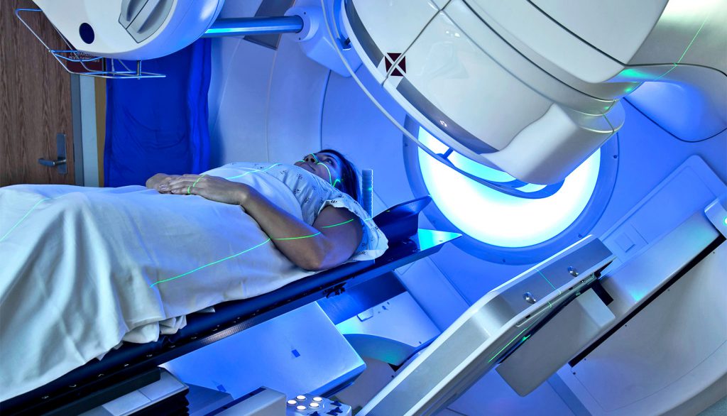 How Is Radiotherapy Given For Lung Cancer