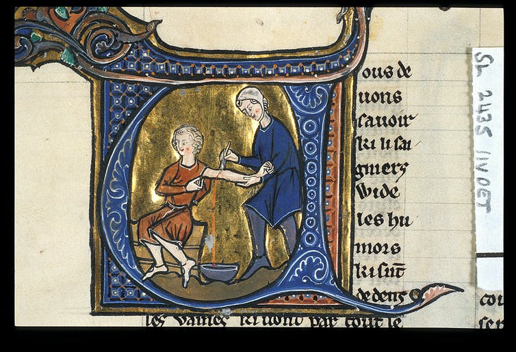 Phlebotomy for love sickness in Aldobrandino of Siena’s ‘Régime du Corps’. British Library, MS Sloane 2435, f.11v. France, late 13thC. Wikimedia Commons 