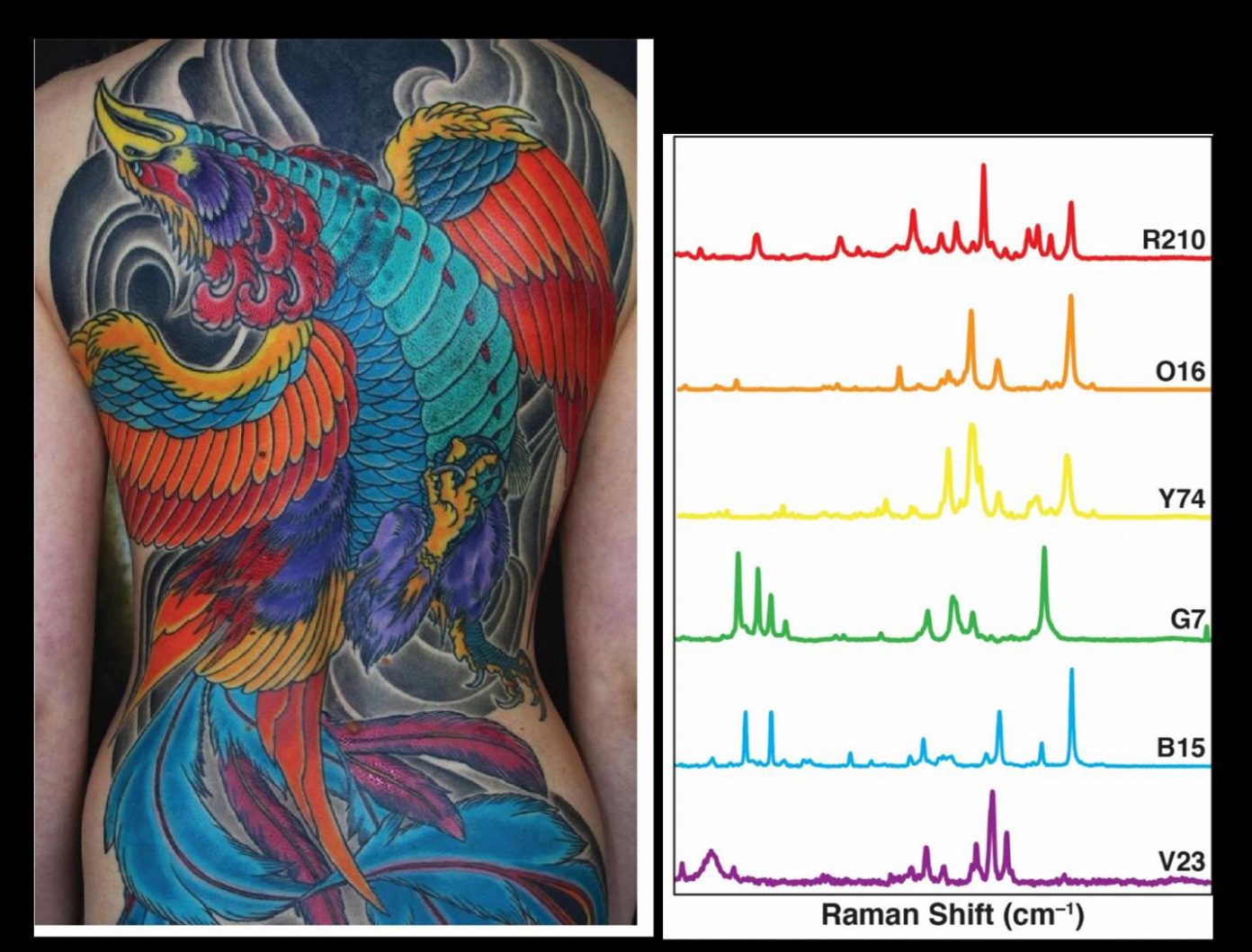 Can Tattoo Ink Detect Cancer? MEDizzy Journal