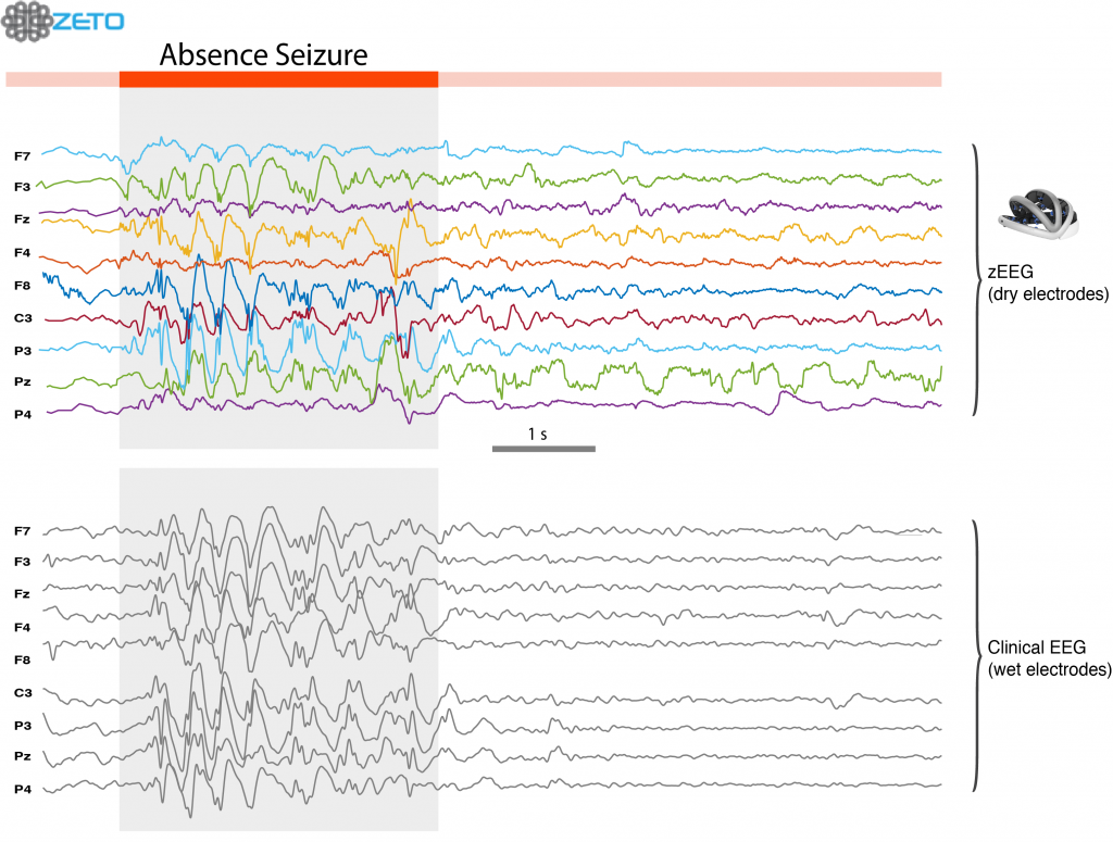 eeg-revolutionized-medizzy-journal