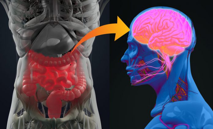 Alzheimer's disease linked to gut bacteria