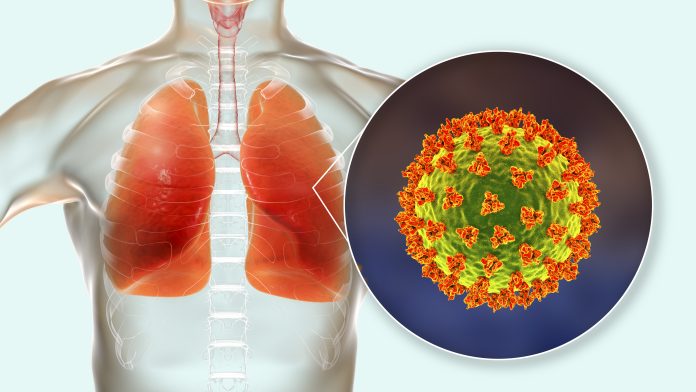 COVID-19 Lung Transplant