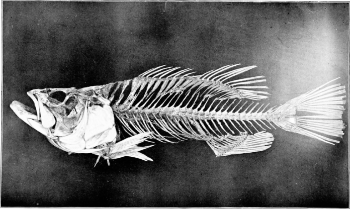 Subcutaenous emphysema caused by fish bone ingestion