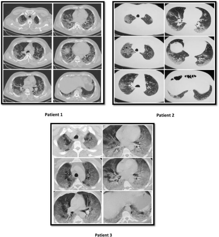 Scans of three brothers