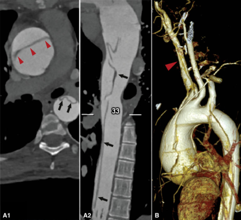 Hysteria In a Medical Student Medical Cases MEDizzy