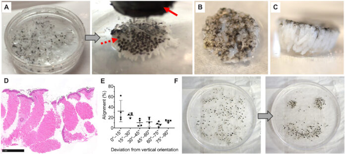 skin grafts