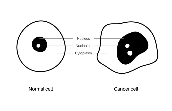 A normal cell vs a tumour cell