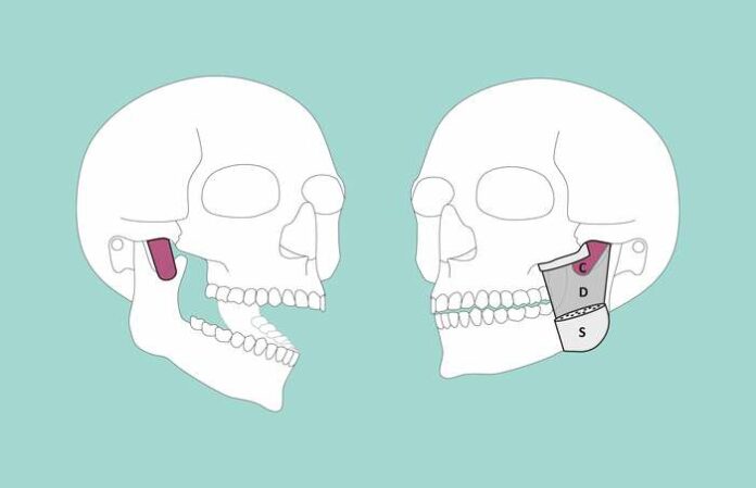 Jaw muscle