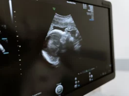 ultrasound