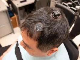 brain implant