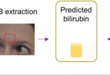 Smartphone Monitors Liver Cirrhosis Patients liver cirrhosis