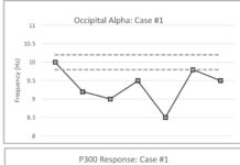 Ketamine Use in PTSD, Depression and Suicidal Ideation