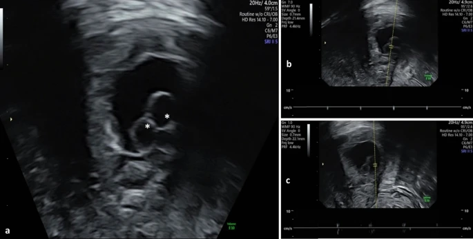 13256_2025_5543_Fig2_HTML ectopic