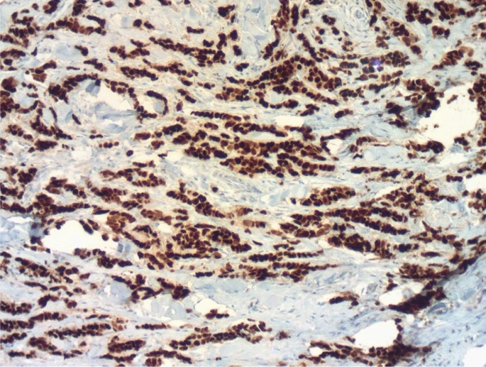 13256_2025_5452_Fig2_HTML breast