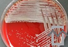 Brevundimonas vesicularis sepsis brevundimonas