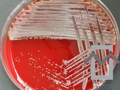 brevundimonas-vesicularis_nf28_bewaarvl_ba_48-2_f-400x300__wm__ brevundimonas