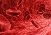 Ultrasound technology to Measure Blood Viscosity viscosity