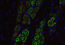 Nasal Nanomedicine to Fight Brain Tumors nanomedicine