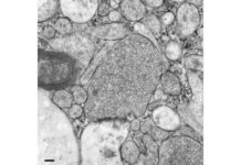 ‘Zap-and-Freeze’ Technique zap and freeze