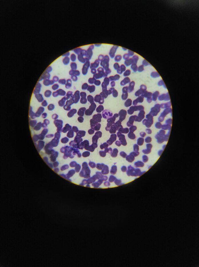 Exportin-1s